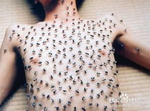 密集恐惧症图片大全,带你领略那些令人毛骨悚然的图片瞬间