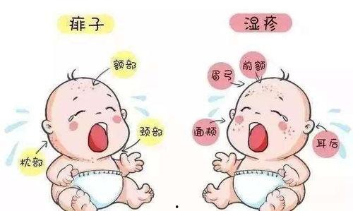 痱子和湿疹的区别图片,视觉对比解析